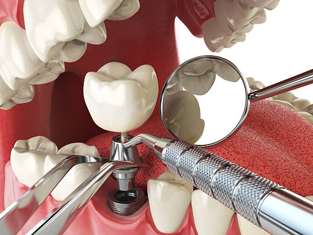 Best Same-Day Emergency Dental Services in Perryville, MO